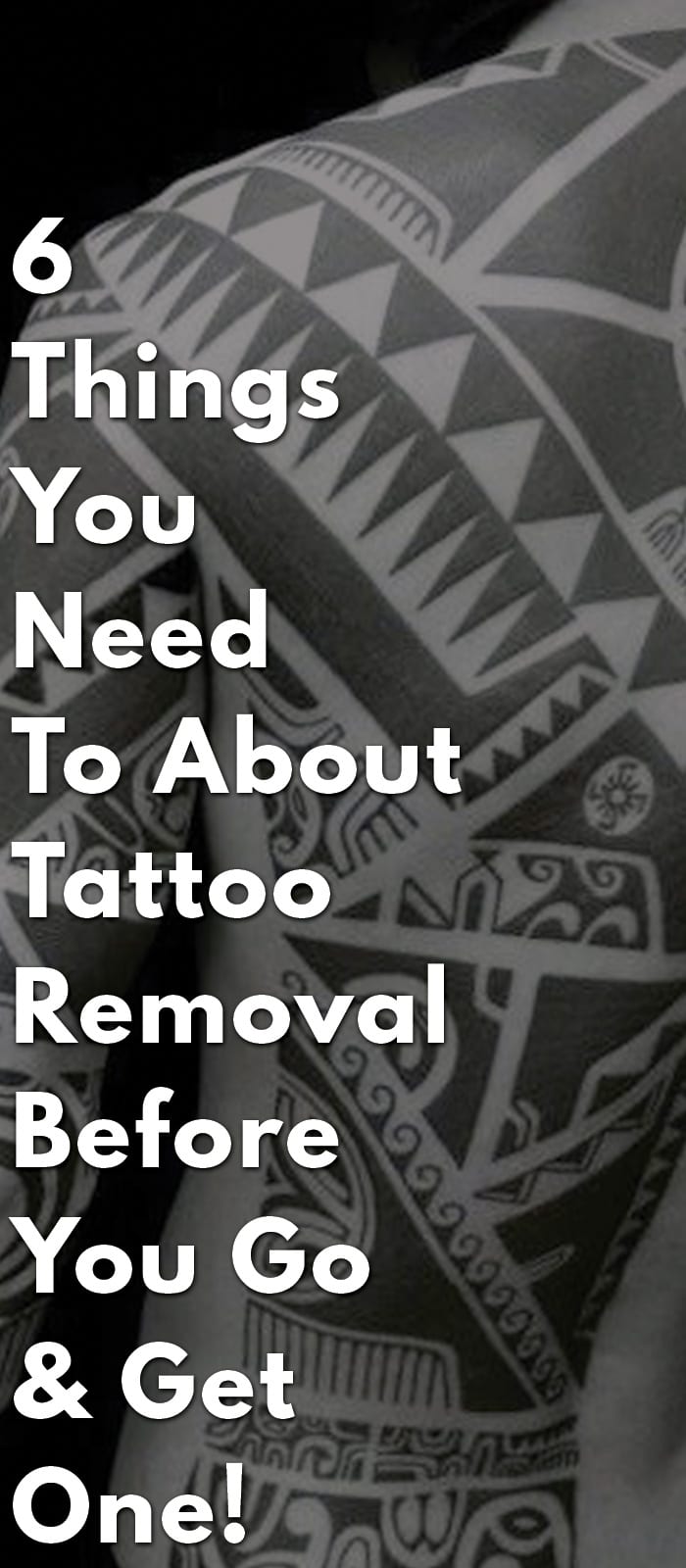 6-Things-You-Need-To-About-Tattoo-Removal-Before-You-Go-&-Get-One! 6-Things-You-Need-To-About-Tattoo-Removal-Before-You-Go-&-Get-One!