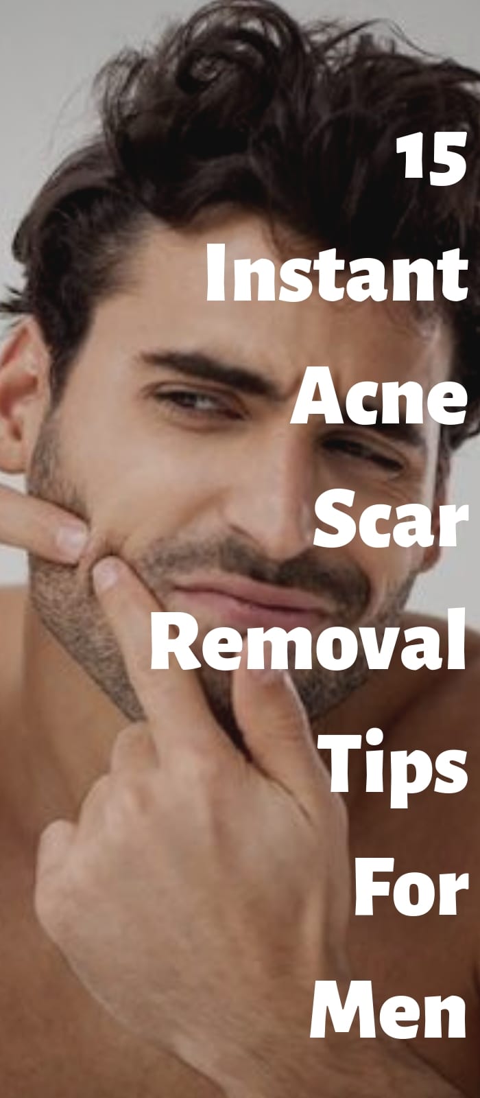 15 Instant Acne Scar Removal Tips For Men 15 Instant Acne Scar Removal Tips For Men