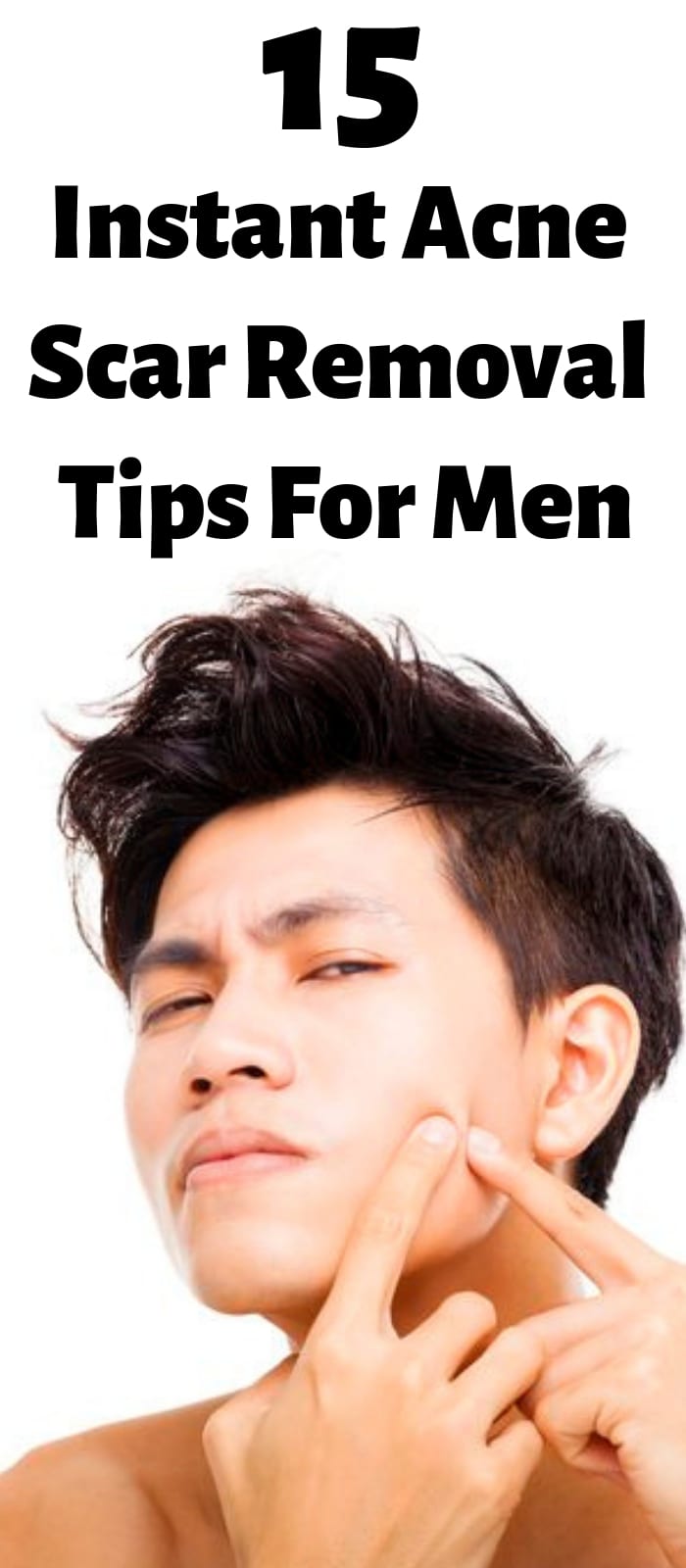 15 Instant Acne Scar Removal Tips For Men 15 Instant Acne Scar Removal Tips For Men