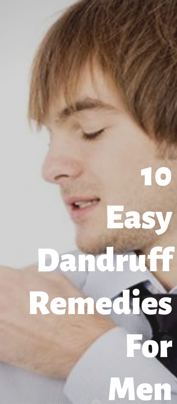 10 Easy Dandruff Remedies For Men 10 Easy Dandruff Remedies For Men