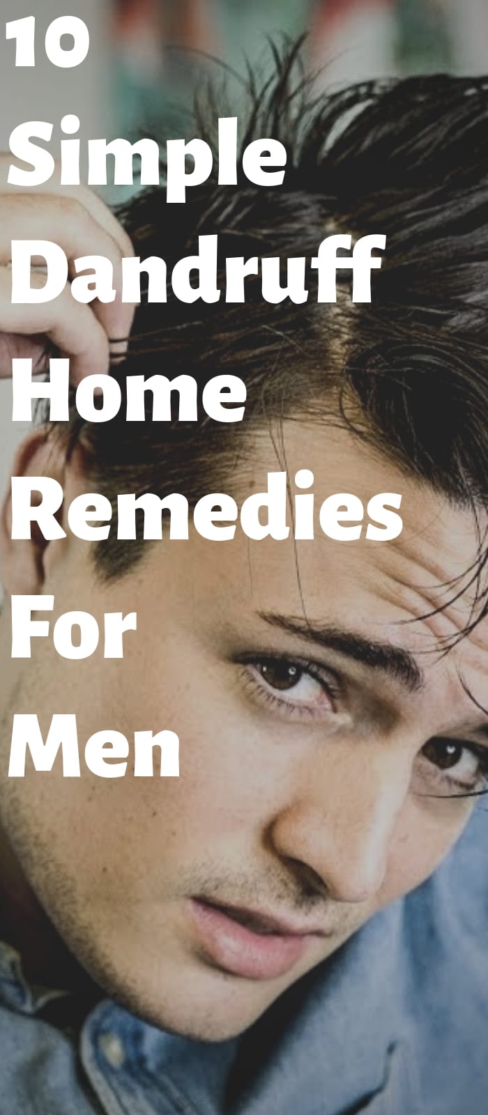 10 Easy Dandruff Remedies For Men! 10 Easy Dandruff Remedies For Men!