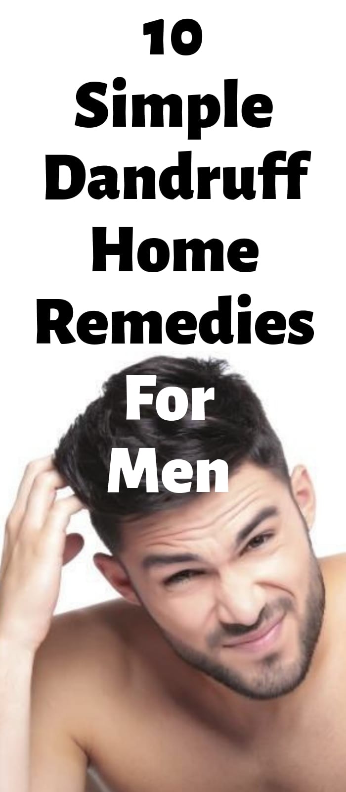 10 Simple Dandruff Home Remedies For Men 10 Simple Dandruff Home Remedies For Men